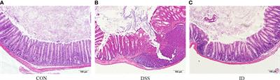 Pretreatment with IPA ameliorates colitis in mice: Colon transcriptome and fecal 16S amplicon profiling